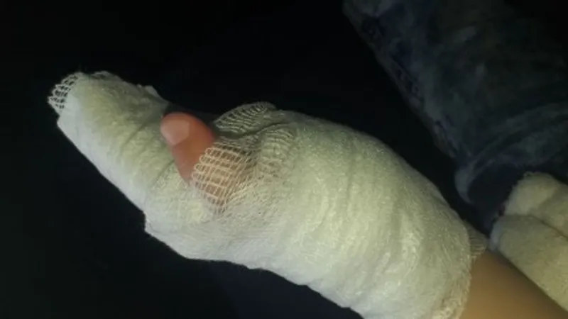 Okulda Korkunç Patlama! Çantadan Çıkan Madde Parmağı Kopardı!