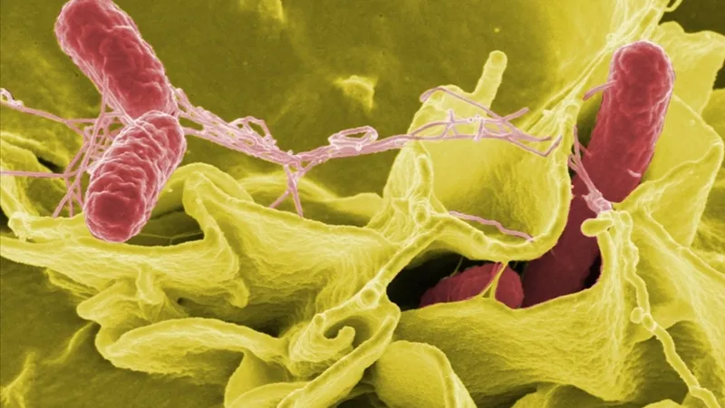Uzmandan salmonella uyarısı: Sadece mideyi değil, organları da vuruyor